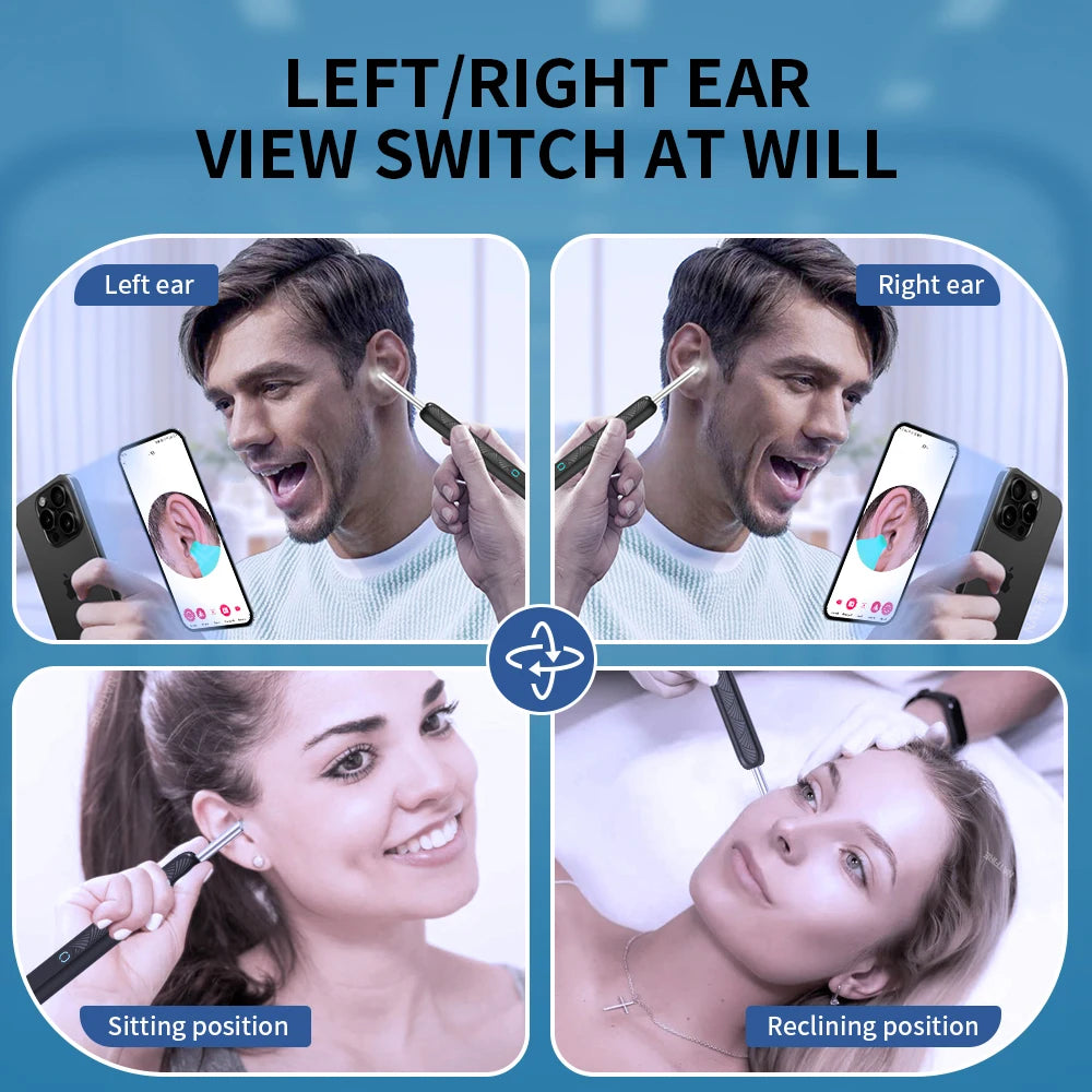 Ear Cleaner with Camera Wireless (Ear Sticks Otoscope)